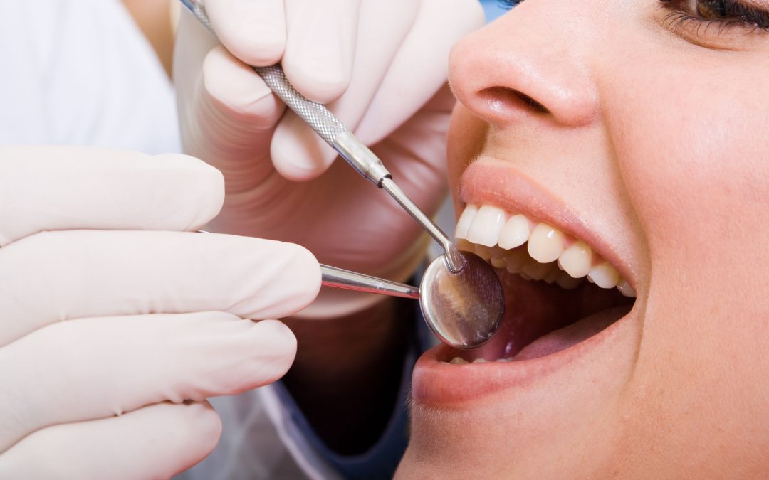 Restore Your Smile with Crowns Albert-Eden Area Dentists Recommend for New Zealanders