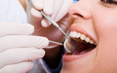 Restore Your Smile with Crowns Albert-Eden Area Dentists Recommend for New Zealanders