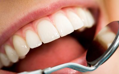 Find Out How Cosmetic Dentures Christchurch Can Enhance Your Smile and Confidence