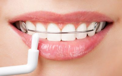 How a Kids Dentist Ashgrove QLD Supports Healthy Smiles for Local Children