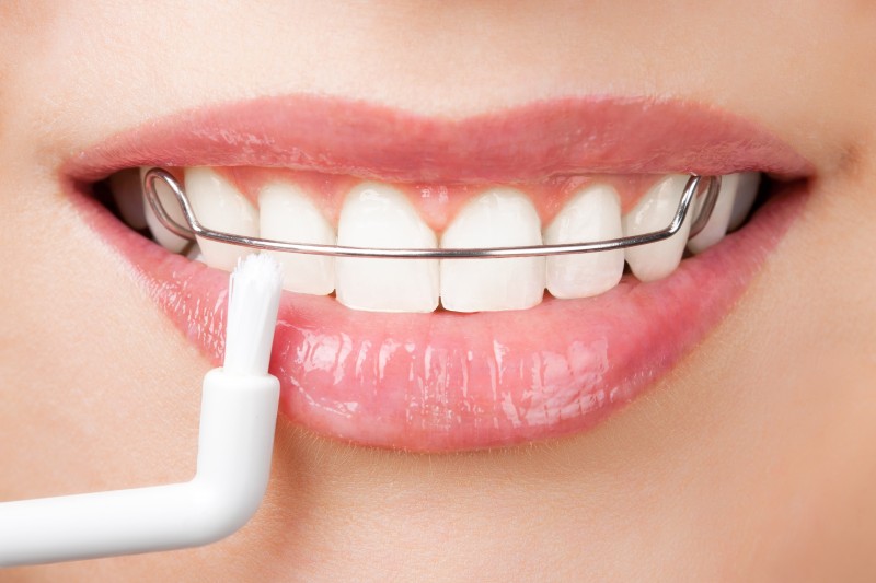 How a Kids Dentist Ashgrove QLD Supports Healthy Smiles for Local Children
